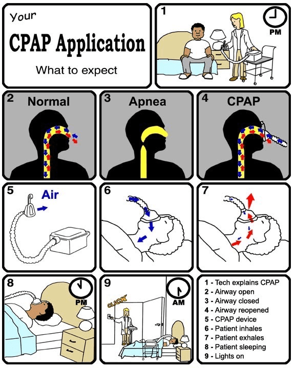 Free CPAP / BiPAP Trial - what to expect